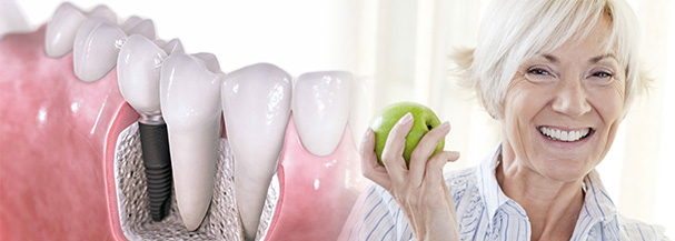 �mplant Di� Hekimli�i